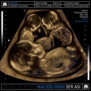 In The Stone & Festa / Este Amor Que Me Mata